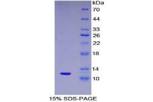 SDS-PAGE analysis of Human MIP5 Protein.