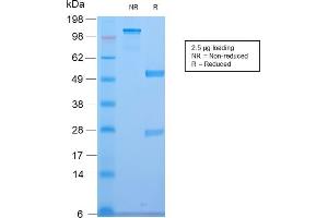SDS-PAGE Analysis of Purified CELA3B Rabbit Recombinant Monoclonal Antibody (CELA3B/2810R). (Recombinant Elastase 3B antibody  (AA 82-238))