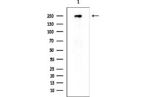 Western blot analysis of lysates from EC304 cells, using MED13L Mouse Monoclonal Antibody at 1/1000 dilution.