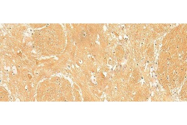 ARPC5L antibody