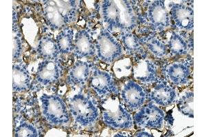 IHC analysis of MCAM using anti-MCAM antibody (ABIN7601026). (MCAM antibody  (AA 27-621))
