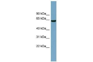 SLC5A8 antibody used at 1 ug/ml to detect target protein. (SLC5A8 antibody)