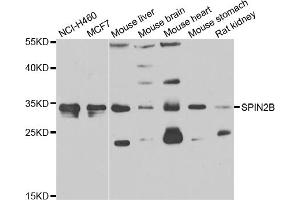 Western blot analysis of extracts of various cell lines, using SPIN2B antibody (ABIN4905283) at 1:1000 dilution. (Spindlin 2B antibody)