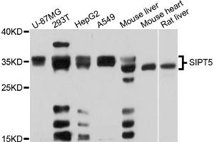 Western blot analysis of extracts of various cell lines, using SIRT5 antibody (ABIN5973406) at 1/1000 dilution. (SIRT5 antibody)