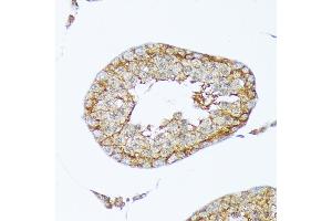 Immunohistochemistry of paraffin-embedded rat testis using Cortactin Rabbit mAb (ABIN7266511) at dilution of 1:100 (40x lens). (Cortactin antibody)