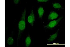 Immunofluorescence of monoclonal antibody to ATRX on HeLa cell. (ATRX antibody  (AA 2311-2410))