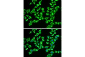 Immunofluorescence analysis of A549 cells using HADHB antibody. (HADHB antibody  (AA 34-270))
