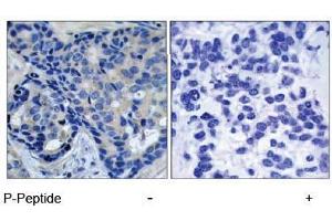 Image no. 1 for anti-PTK2B Protein tyrosine Kinase 2 beta (PTK2B) (pTyr402) antibody (ABIN196953) (PTK2B antibody  (pTyr402))