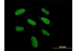 Immunofluorescence of purified MaxPab antibody to DGCR6 on HepG2 cell. (DGCR6 antibody  (AA 1-220))