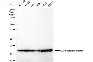 Western blotting analysis using ADP ribosylation factor 1 antibody (ABIN7797530). (Recombinant ARF1 antibody)