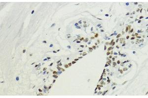 Immunohistochemistry of paraffin-embedded Human breast using DiMethyl-Histone H3-K36 Polyclonal Antibody at dilution of 1:200 (40x lens). (Histone 3 antibody  (2meLys36))