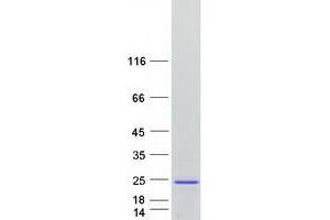 Validation with Western Blot (SPANXN4 Protein (Myc-DYKDDDDK Tag))
