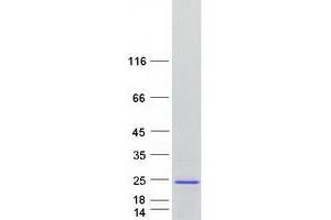 Validation with Western Blot