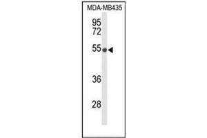 Western blot analysis of DMC1 Antibody (N-term) in MDA-MB435 cell line lysates (35ug/lane). (DMC1 antibody  (N-Term))