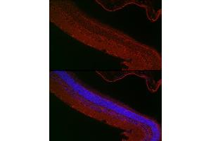 Immunofluorescence analysis of mouse retina cells using RPGR Rabbit pAb (ABIN3015609, ABIN3015610, ABIN3015611, ABIN1682567 and ABIN6218971) at dilution of 1:50 (40x lens).
