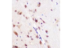 Immunohistochemistry of paraffin-embedded Rat brain using CELF1 Rabbit pAb (ABIN6131012, ABIN6138399, ABIN6138400 and ABIN6221641) at dilution of 1:100 (40x lens). (CELF1 antibody  (AA 108-483))