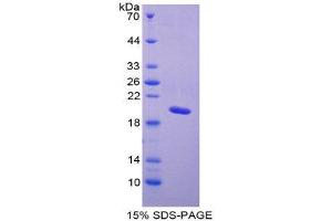 SDS-PAGE (SDS) image for Natriuretic Peptide A (NPPA) (AA 25-152) protein (His tag) (ABIN2123808) (NPPA Protein (AA 25-152) (His tag))