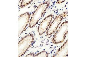 Immunohistochemical analysis of paraffin-embedded H. (CSE1L antibody  (N-Term))