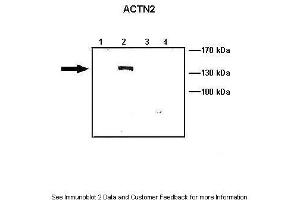 Lanes:   Lane1: 10 ug ACTN1-GFP transfected COS-7 lysate Lane2: 10 ug ACTN2-GFP transfected COS-7 lysate Lane3: 10 ug ACTN3-GFP transfected COS-7 lysate Lane4: 10 ug ACTN4-GFP transfected COS-7 lysate  Primary Antibody Dilution:   1: 1000  Secondary Antibody:   Anti-rabbit HRP  Secondary Antibody Dilution:   1:5000  Gene Name:   ACTN2  Submitted by:   Johannes W.
