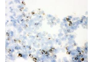 IHC testing of frozen rat lung with SFTPA1/2 antibody. (SFTPA1/ 2 antibody)