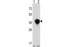 Western Blotting (WB) image for anti-Transaldolase 1 (TALDO1) antibody (ABIN3002744) (TALDO1 antibody)