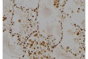 ABIN6277485 at 1/100 staining Human lung tissue by IHC-P. (RAD23A antibody  (C-Term))