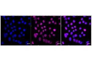Immunocytochemical staining of HepG2 cells with Lysine demethylase 1B antibody (ABIN7799298), 1:1,000). (Recombinant KDM1B antibody)