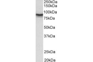 Staining of Mouse Brain lysate usng DLG4 / PSD95 antibody at 0. (DLG4 antibody  (Internal Region))