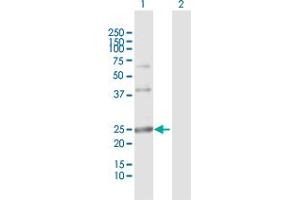 Western Blot analysis of ARL4D expression in transfected 293T cell line by ARL4D MaxPab polyclonal antibody. (ARL4D antibody  (AA 1-201))