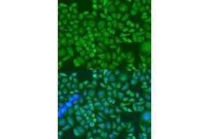Immunofluorescence analysis of U2OS cells using IGF2BP2/IMP2 antibody (ABIN6134718, ABIN6142241, ABIN6142243 and ABIN6218347) at dilution of 1:100. (IGF2BP2 antibody  (C-Term))
