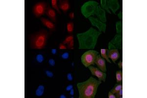 ABIN6263312 and ABIN6266806 staining Hela cells by IF/ICC.