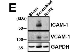 R1R2 decreases inflammatory cell accumulation and VCAM-1 and ICAM-1 levels. (ICAM1 antibody)