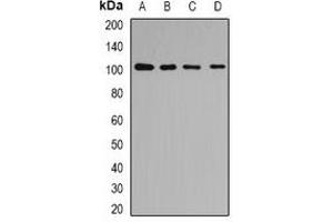 Western blot analysis of p102 expression in Hela (A), HepG2 (B), mouse liver (C), mouse kidney (D) whole cell lysates. (COPB2 antibody)