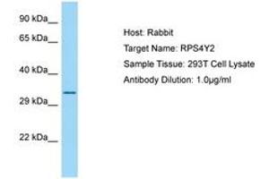 Image no. 1 for anti-Ribosomal Protein S4, Y-Linked 2 (RPS4Y2) (AA 166-215) antibody (ABIN6749893) (RPS4Y2 antibody  (AA 166-215))