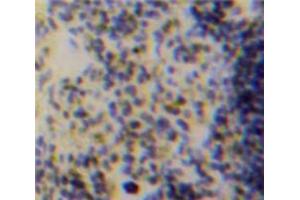 Used in DAB staining on fromalin fixed paraffin-embedded Spleen tissue (ACP5 antibody  (AA 28-286))
