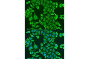 Immunofluorescence analysis of U2OS cells using PDK2 antibody (ABIN1681304, ABIN3018413, ABIN3018414 and ABIN6220461) at dilution of 1:100. (PDK2 antibody  (AA 128-407))
