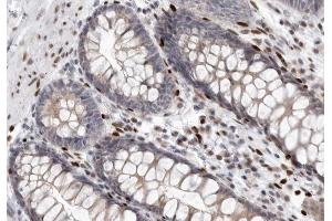 Immunohistochemistry (IHC) image for anti-Claudin 3 (CLDN3) (C-Term) antibody (ABIN6260865)