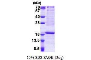 SDS-PAGE (SDS) image for Ribosomal Protein L22 (RPL22) (AA 1-128) protein (His tag) (ABIN5853080) (RPL22 Protein (AA 1-128) (His tag))