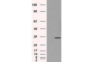 Image no. 2 for anti-Fc Fragment of IgG, Low Affinity IIa, Receptor (CD32) (FCGR2A) antibody (ABIN1497263) (FCGR2A antibody)