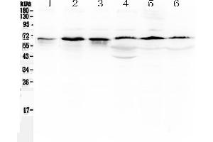 Western blot analysis of TRAF5 using anti-TRAF5 antibody . (TRAF5 antibody  (AA 277-557))