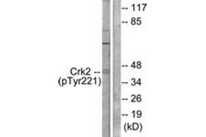 Western blot analysis of extracts from COS7 cells, using CrkII (Phospho-Tyr221) Antibody. (Crk antibody  (pTyr221))
