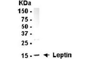 Western Blotting (WB) image for anti-Leptin (LEP) (full length) antibody (ABIN2467855) (Leptin antibody  (full length))