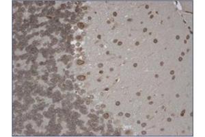 Immunohistochemistry (IHC) image for anti-Transient Receptor Potential Cation Channel, Subfamily M, Member 7 (TRPM7) (AA 1817-1863), (C-Term) antibody (ABIN452417) (TRPM7 antibody  (C-Term))