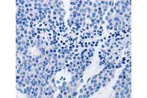 Immunohistochemistry (IHC) image for anti-TNF Receptor-Associated Protein 1 (TRAP1) antibody (ABIN1875197) (TRAP1 antibody)