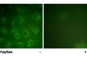 Immunofluorescence analysis of COS-7 cells, using PDGFRB polyclonal antibody . (PDGFRB antibody)