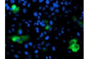 Anti-DPP9 mouse monoclonal antibody (ABIN2455318) immunofluorescent staining of COS7 cells transiently transfected by pCMV6-ENTRY DPP9 (RC224465). (DPP9 antibody)