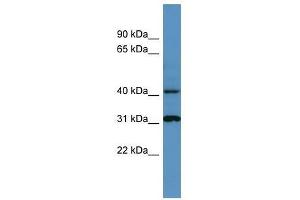 Western Blot showing Ctsd antibody used at a concentration of 1-2 ug/ml to detect its target protein. (Cathepsin D antibody  (C-Term))