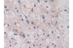 Immunohistochemistry (IHC) image for anti-Integrin beta 1 (ITGB1) (AA 140-383) antibody (ABIN7433060)
