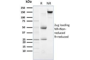 SDS-PAGE Analysis Purified PLK1 Mouse Monoclonal Antibody (AZ44). (PLK1.S antibody)