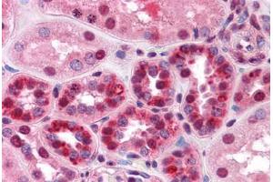 Human Kidney: Formalin-Fixed, Paraffin-Embedded (FFPE) (TARDBP antibody  (AA 1-261))